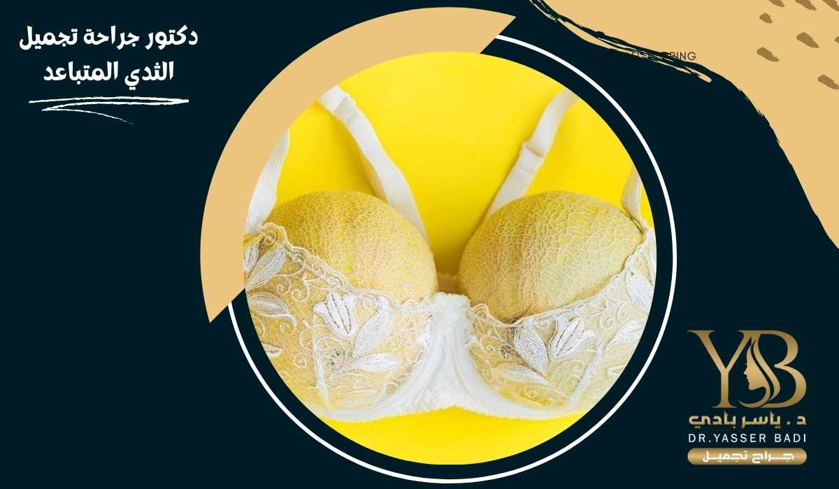 دكتور جراحة تجميل الثدي المتباعد