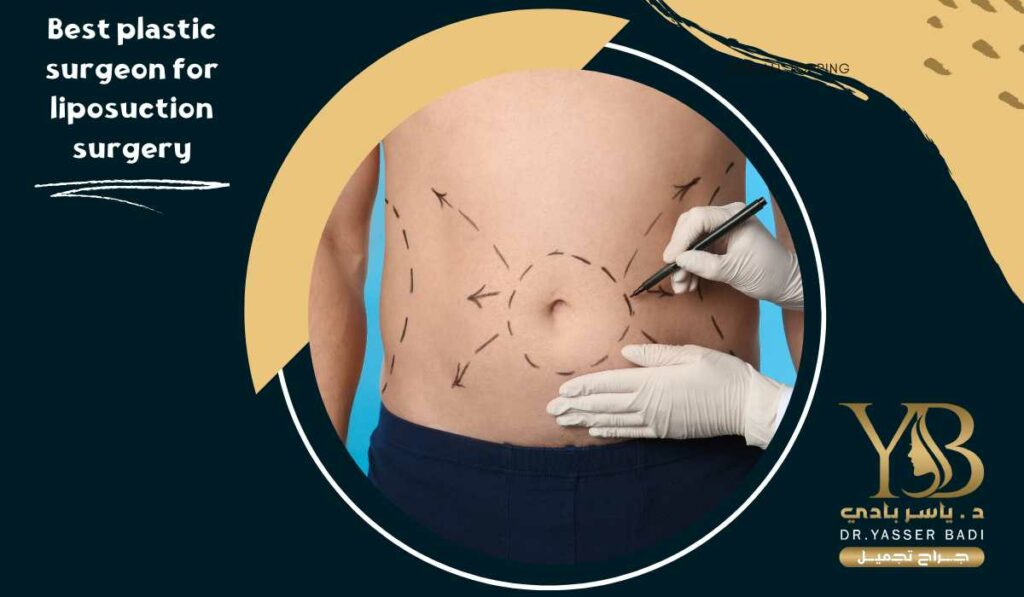 Best plastic surgeon for liposuction surgery