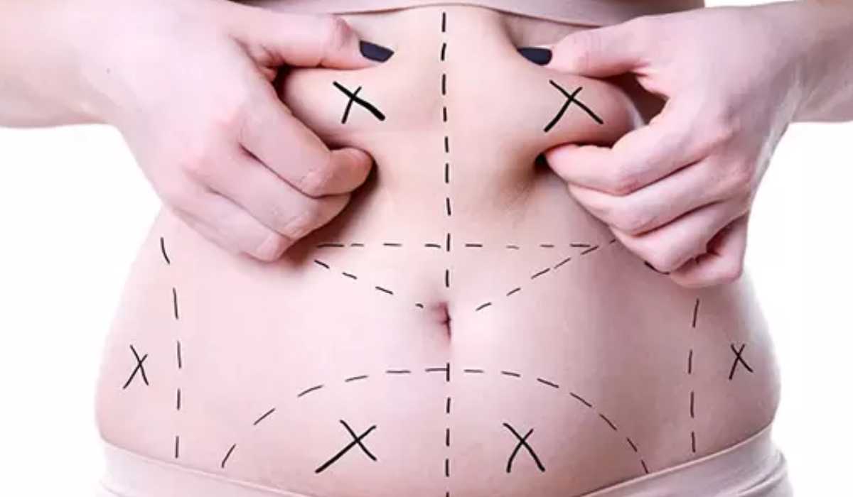 Best plastic surgeon for mommy makeover surgery