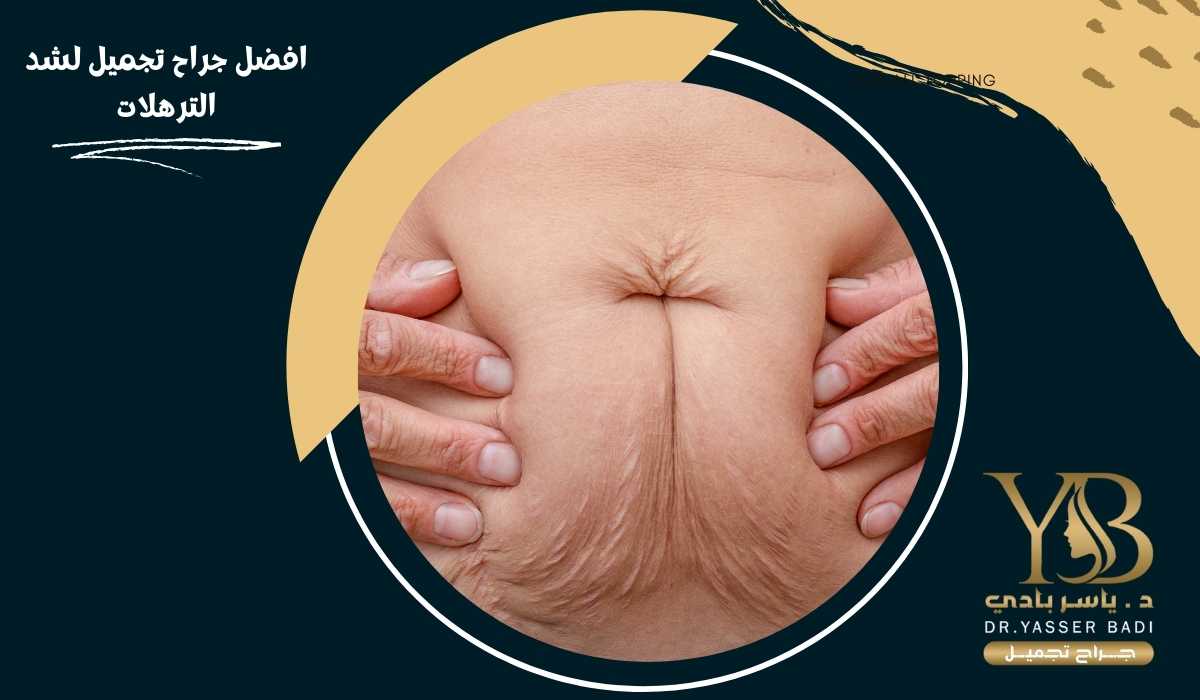 افضل جراح تجميل لشد الترهلات