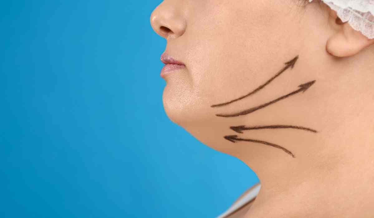 Best plastic surgeon for facial liposuction