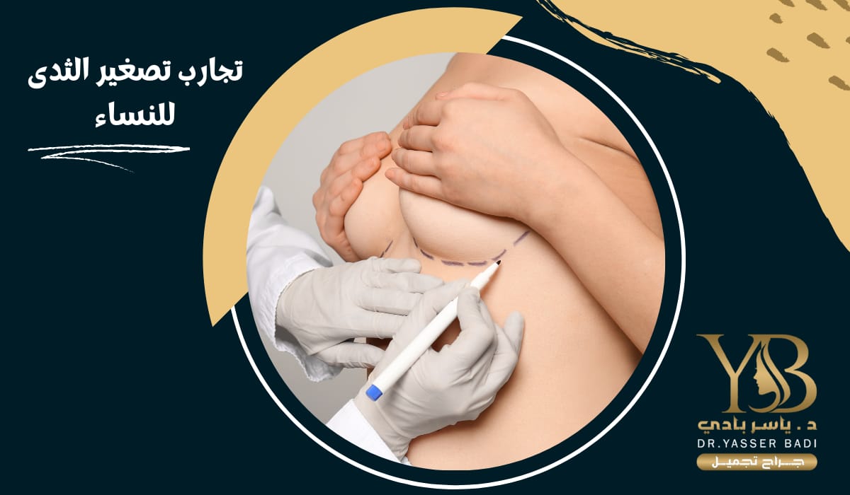 تجارب تصغير الثدي للنساء