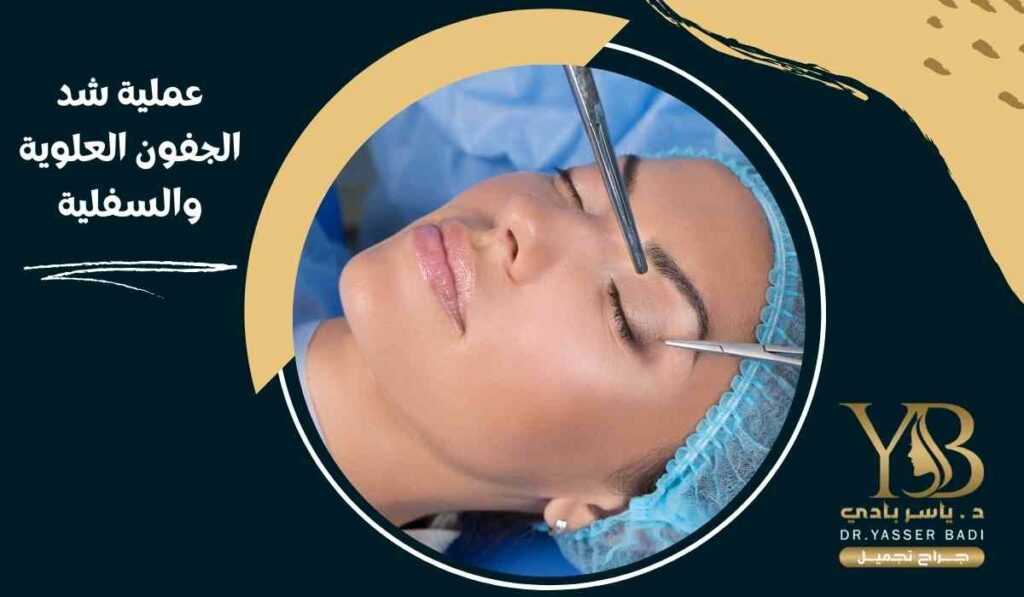 عملية شد الجفون العلوية والسفلية