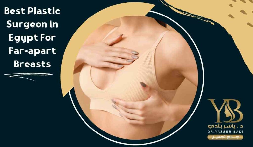 Best plastic surgeon in Egypt for far apart breasts