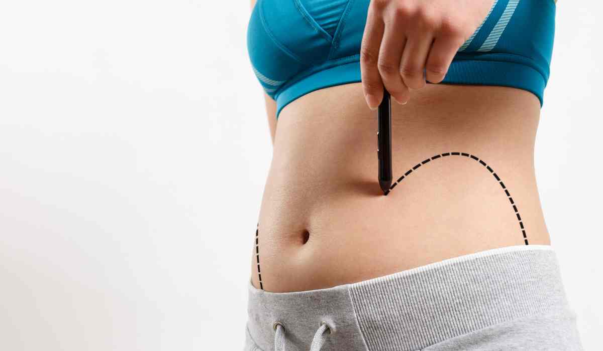 Cost Of Liposuction With The Plastic Surgeon In Egypt