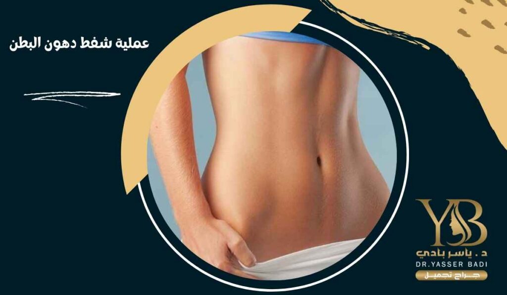 عملية شفط دهون البطن