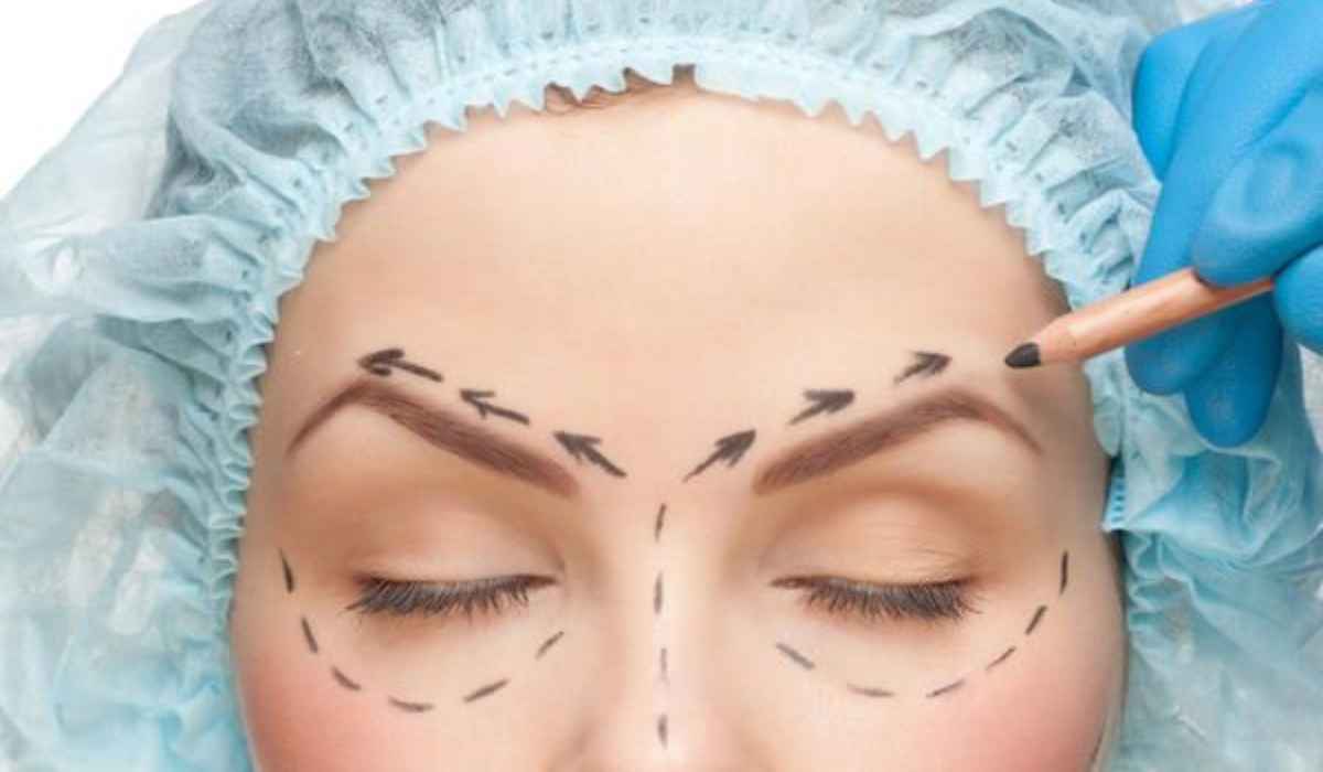 Upper and lower eyelid surgery