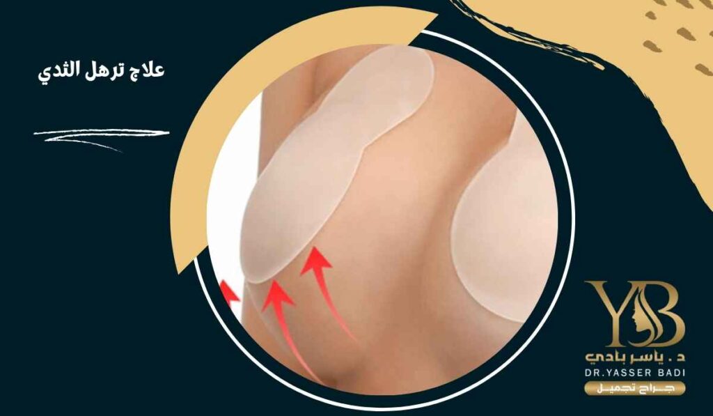 علاج ترهل الثدي