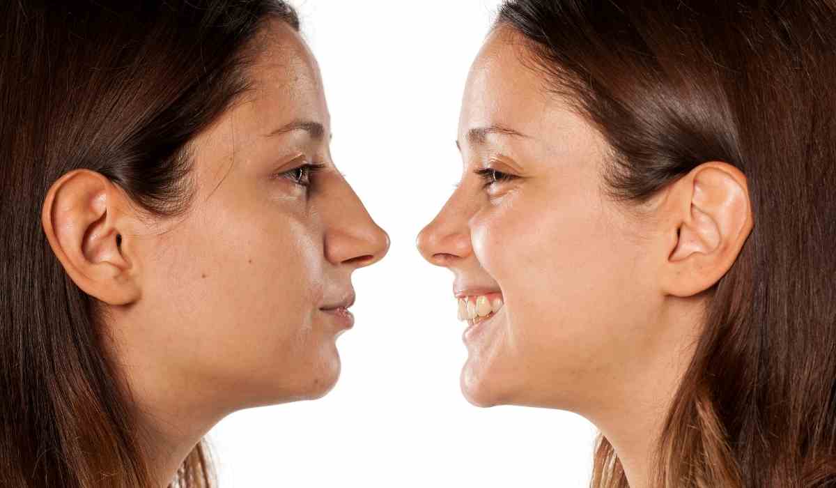 تكلفة عملية تجميل الانف في مصر