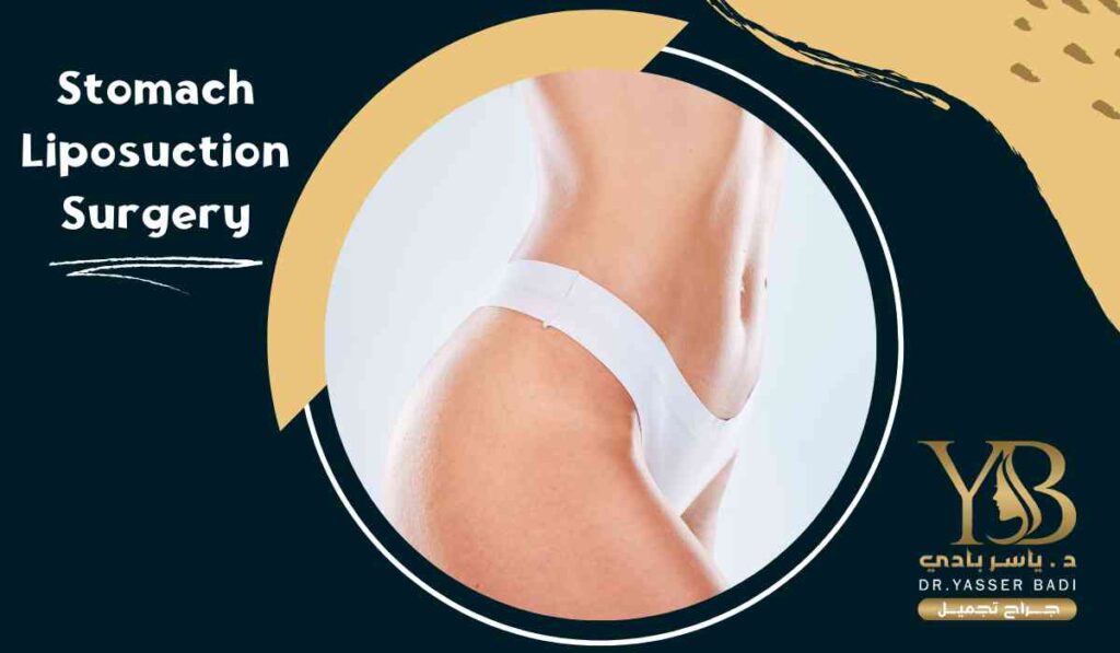 Stomach Liposuction Surgery