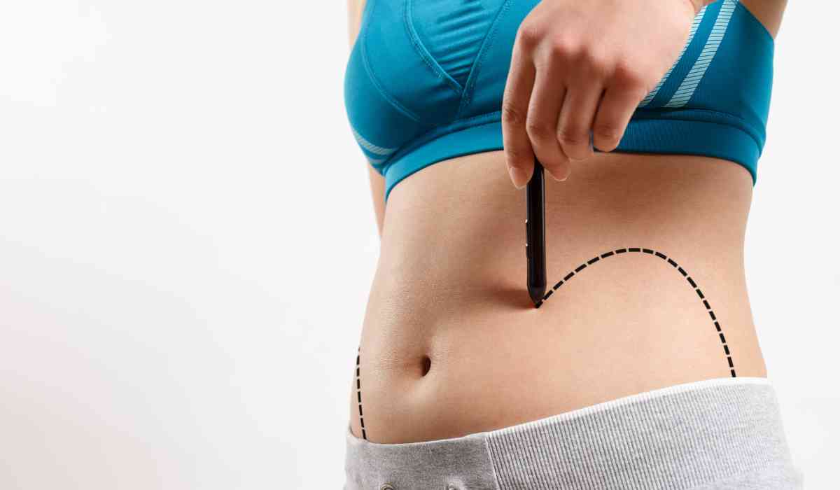 Stomach Liposuction Surgery