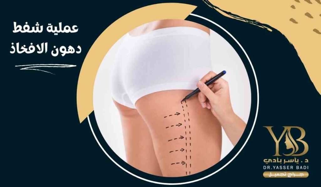 عملية شفط دهون الافخاذ