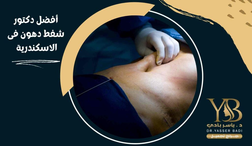 أفضل دكتور شفط دهون فى الاسكندرية