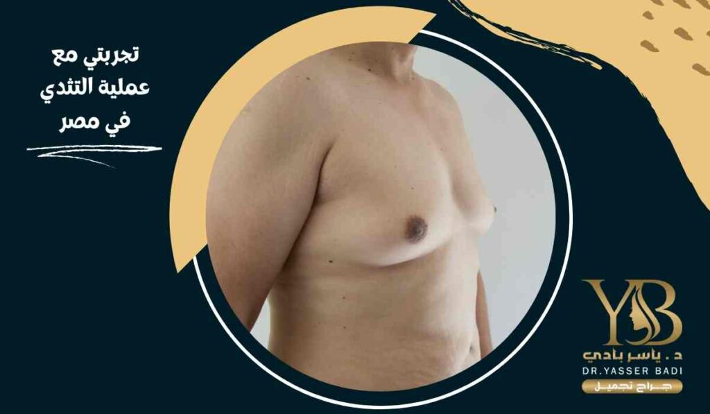 تجربتي مع عملية التثدي في مصر