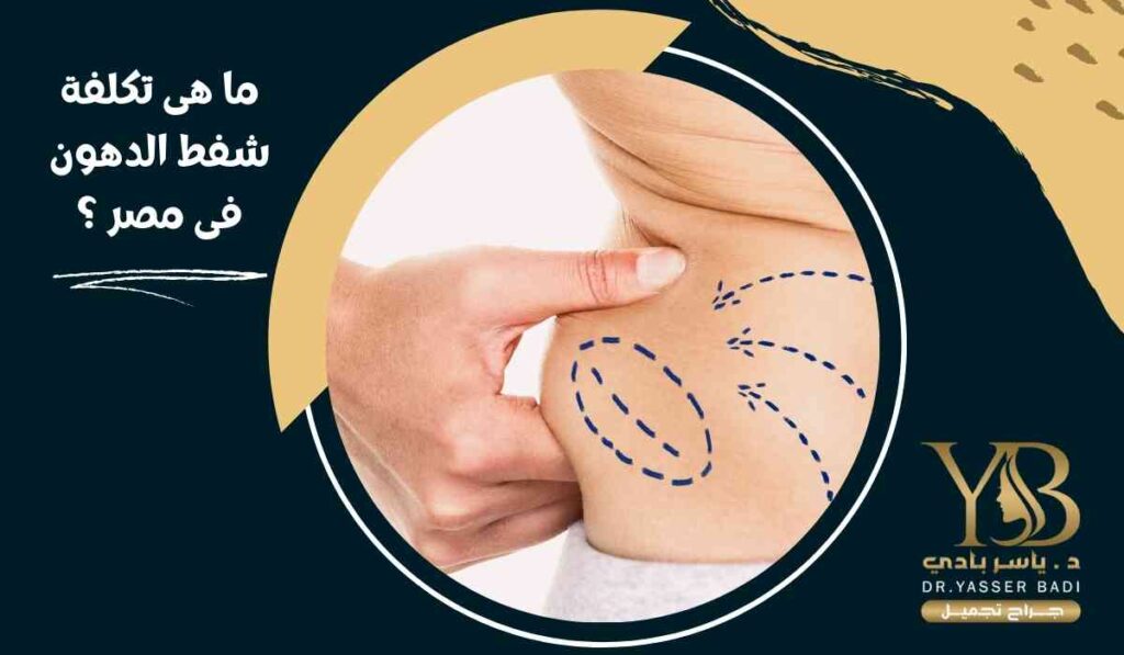 ما هى تكلفة شفط الدهون فى مصر؟