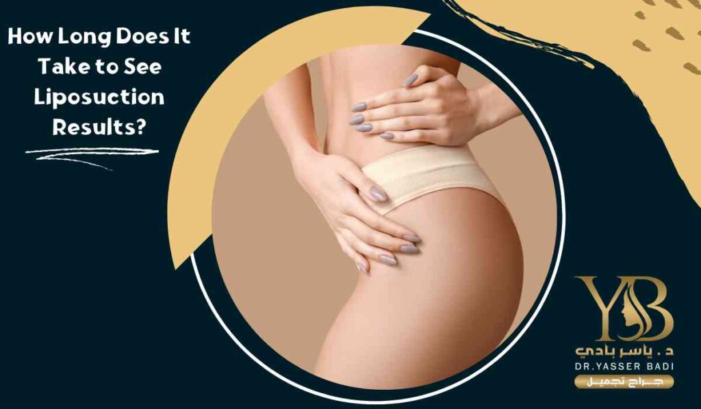 How-Long-Does-It-Take-to-See-Liposuction-Results