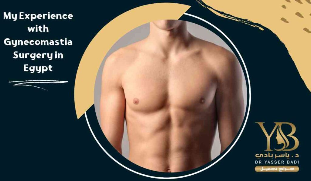 My-Experience-with-Gynecomastia-Surgery-in-Egypt