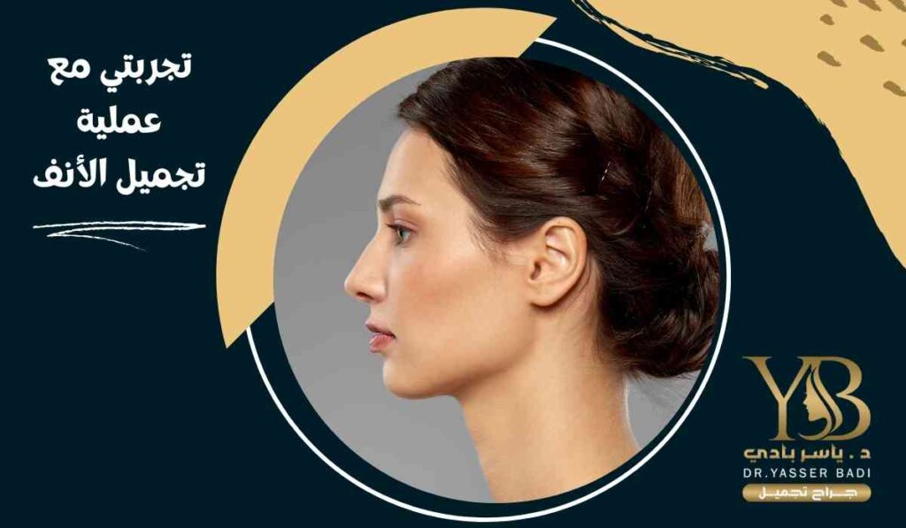 تجربتي-مع-عملية-تجميل-الأنف