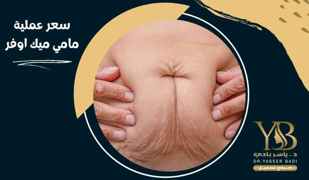 سعر-عملية-مامي-ميك-اوفر