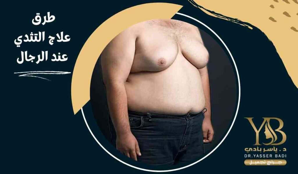 طرق-علاج-التثدي-عند-الرجال